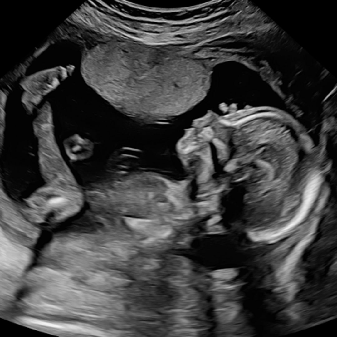 Photo shared by Camille for their Babylist baby registry.