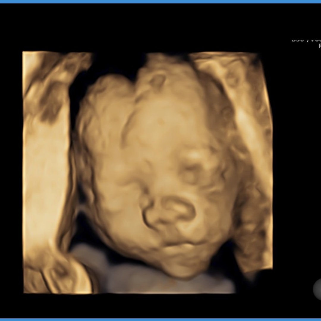 Photo shared by Analiza for their Babylist baby registry.