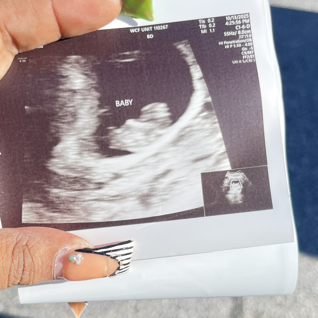 Photo shared by Aaliyah for their Babylist baby registry.