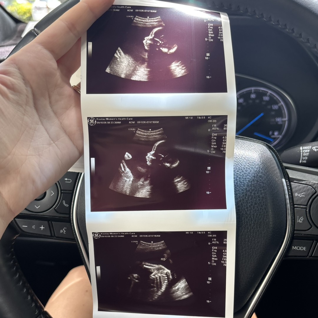 Photo shared by Gabi & Joseph for their Babylist baby registry.