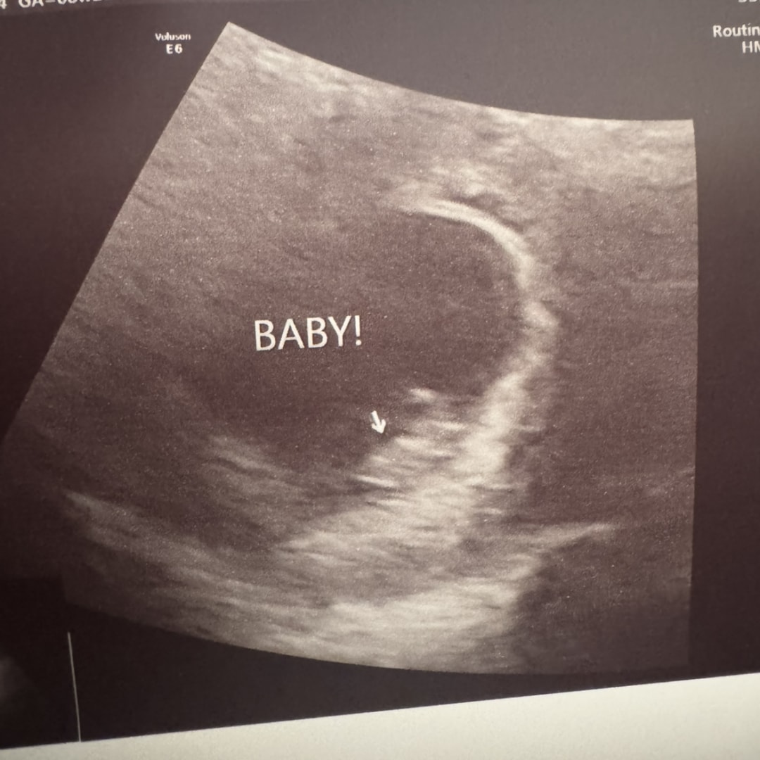 Photo shared by Taylor for their Babylist baby registry.