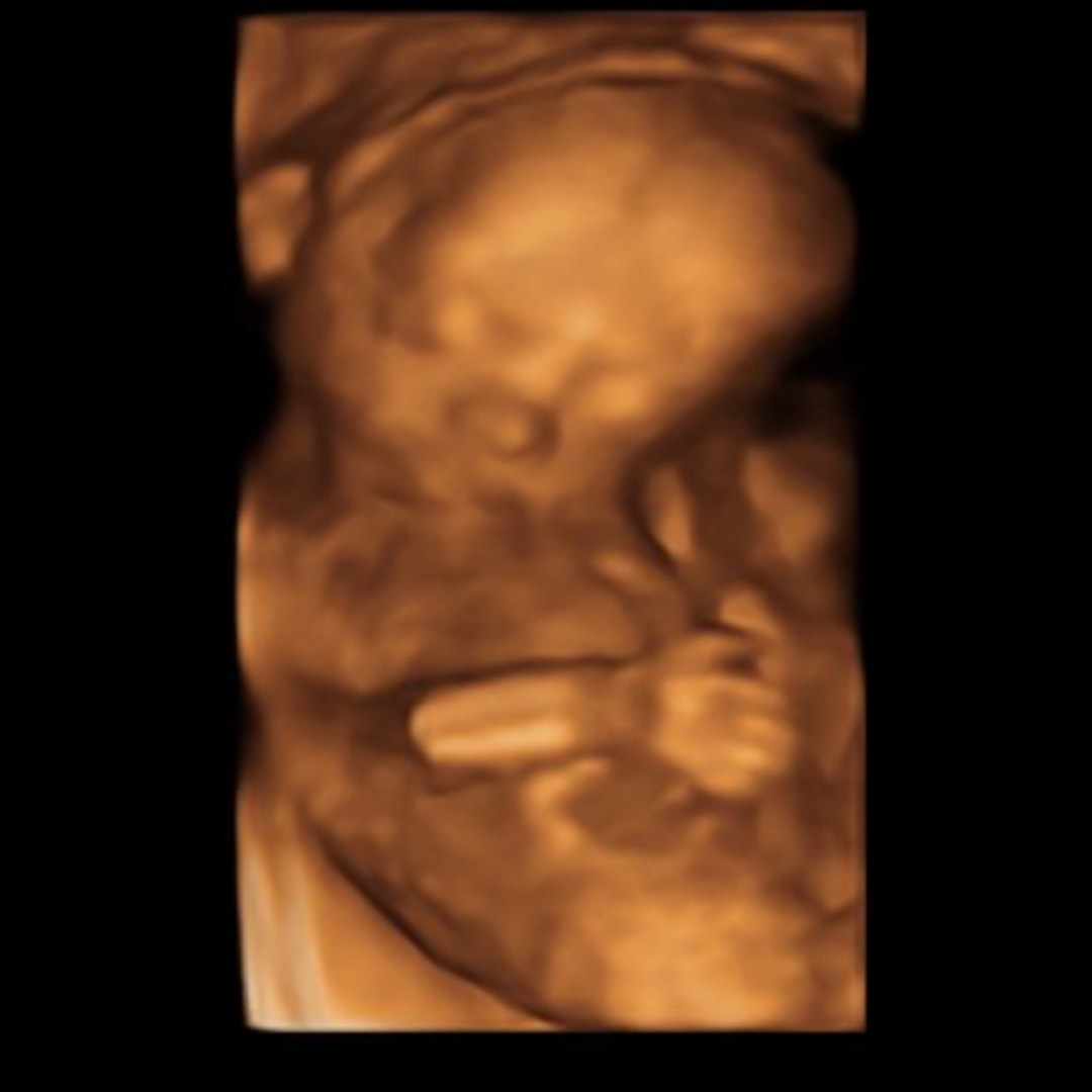 Photo shared by Marley for their Babylist baby registry.