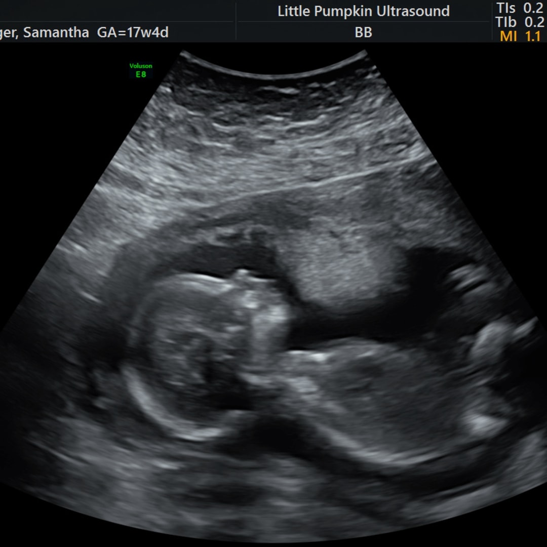 Photo shared by Sam for their Babylist baby registry.