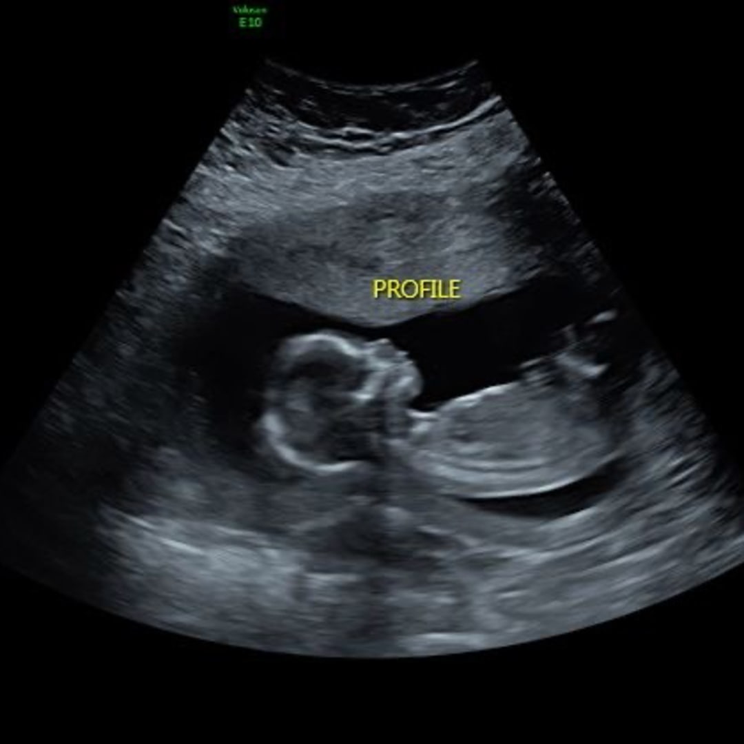 Photo shared by Brittany for their Babylist baby registry.