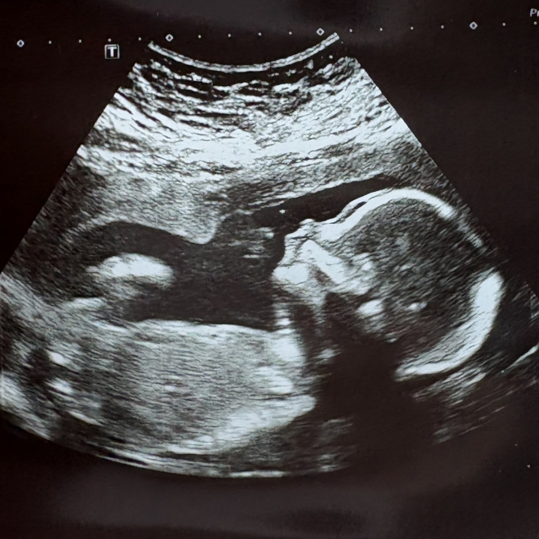 Photo shared by Hillary for their Babylist baby registry.