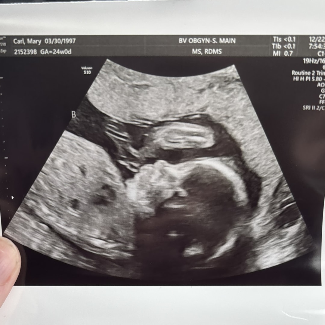 Photo shared by Abbey for their Babylist baby registry.