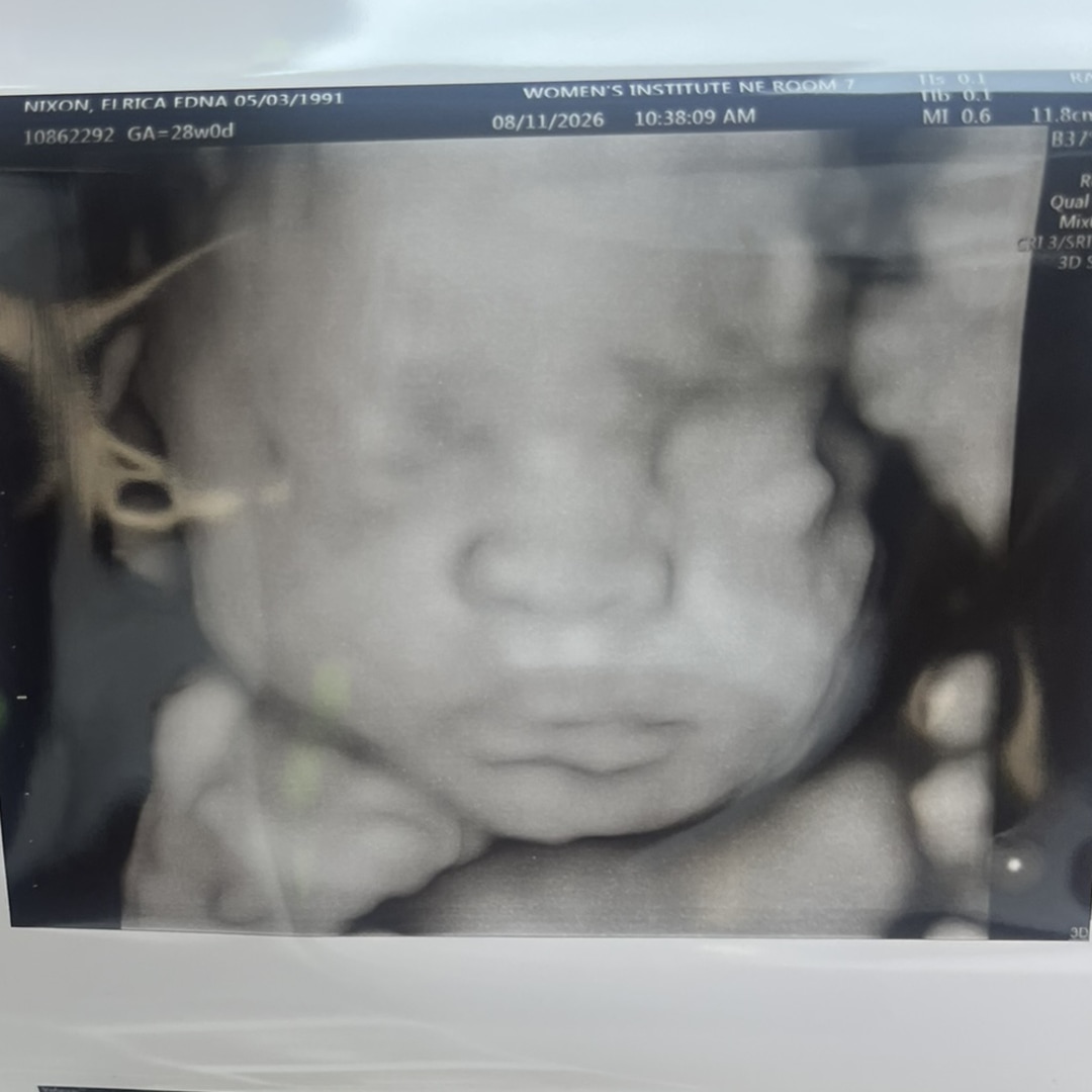 Photo shared by Elrica for their Babylist baby registry.