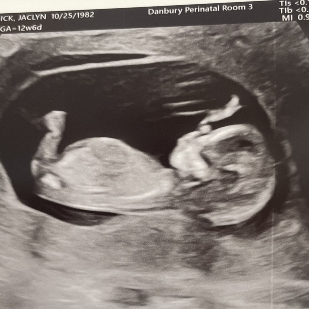 Photo shared by Jaclyn for their Babylist baby registry.