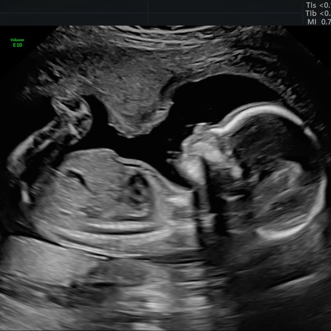 Photo shared by Tayler for their Babylist baby registry.