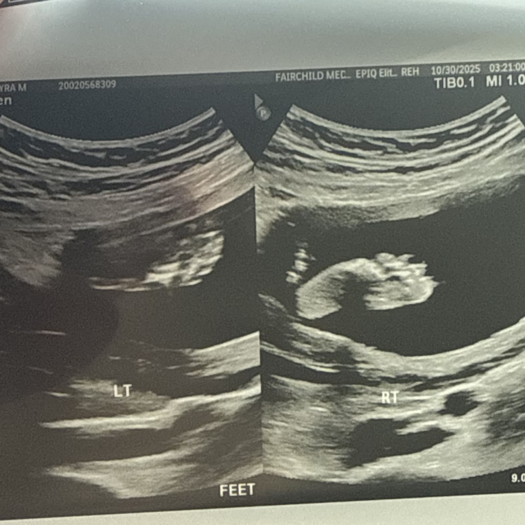 Photo shared by Kyra for their Babylist baby registry.