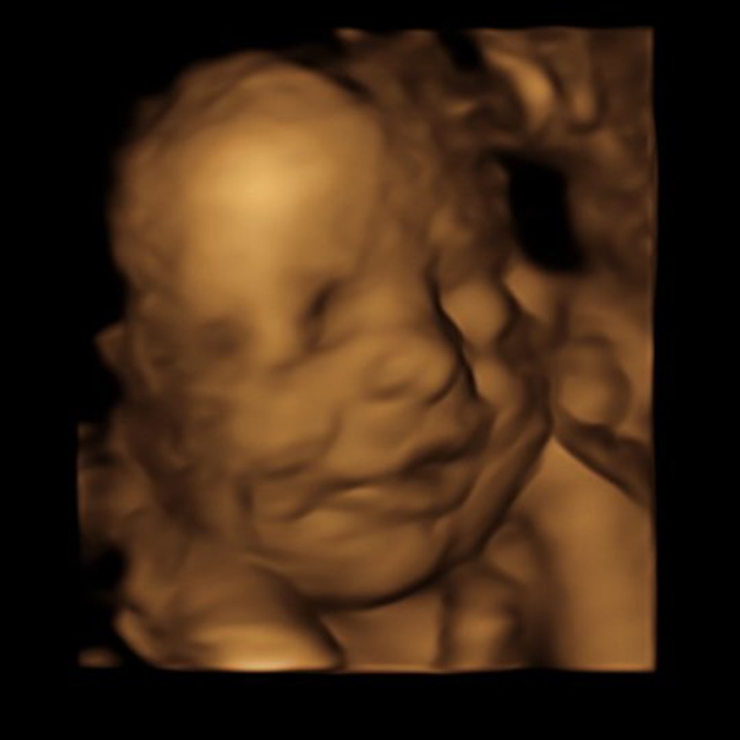 Photo shared by Haley for their Babylist baby registry.