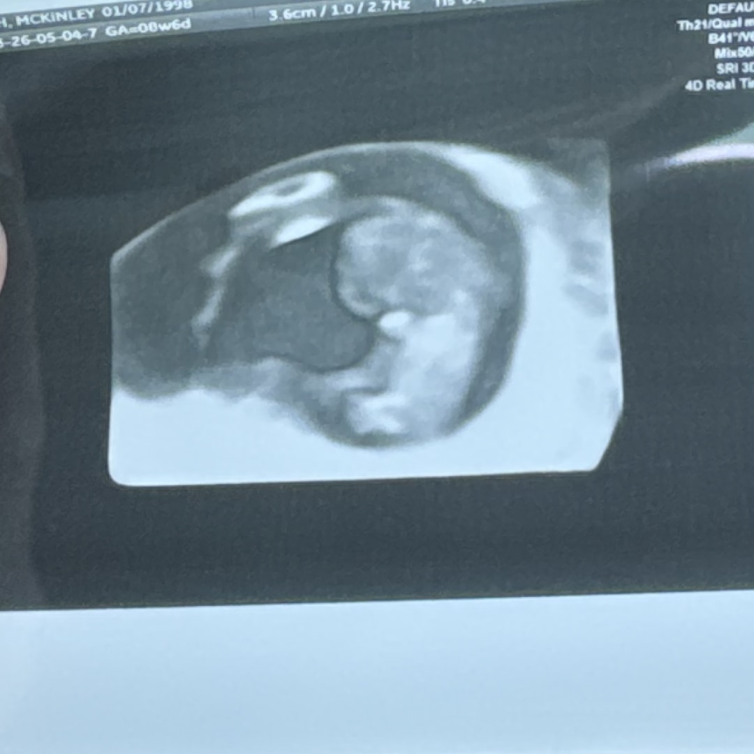 Photo shared by Mckinly for their Babylist baby registry.