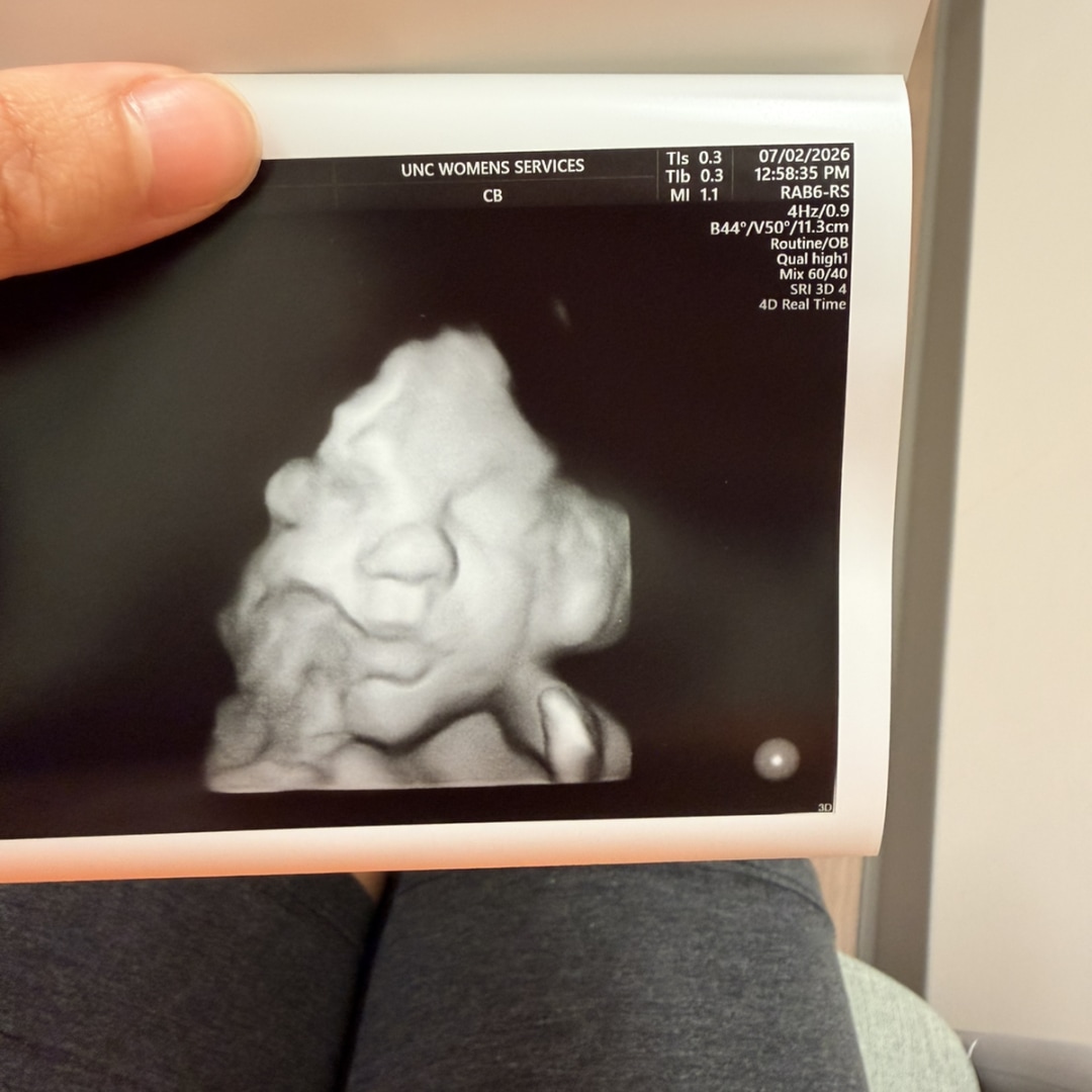 Photo shared by Mackenzie for their Babylist baby registry.