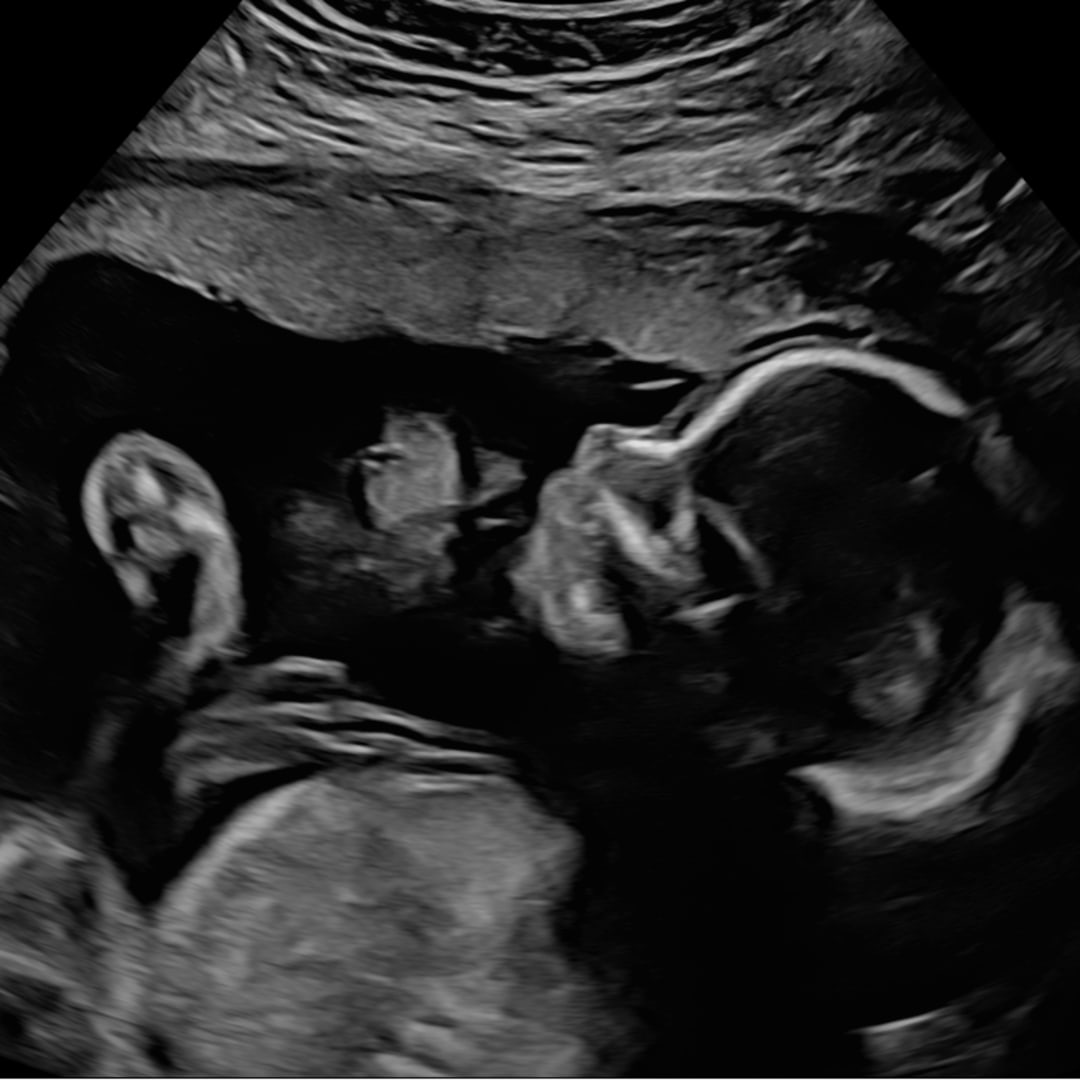 Photo shared by Payton for their Babylist baby registry.