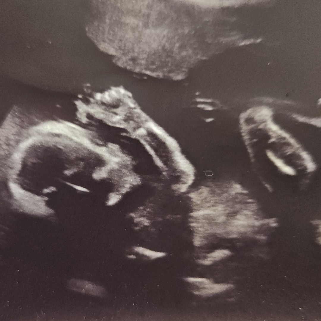 Photo shared by Casandra for their Babylist baby registry.