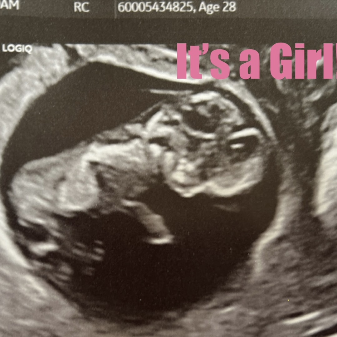 Photo shared by Madalyn for their Babylist baby registry.