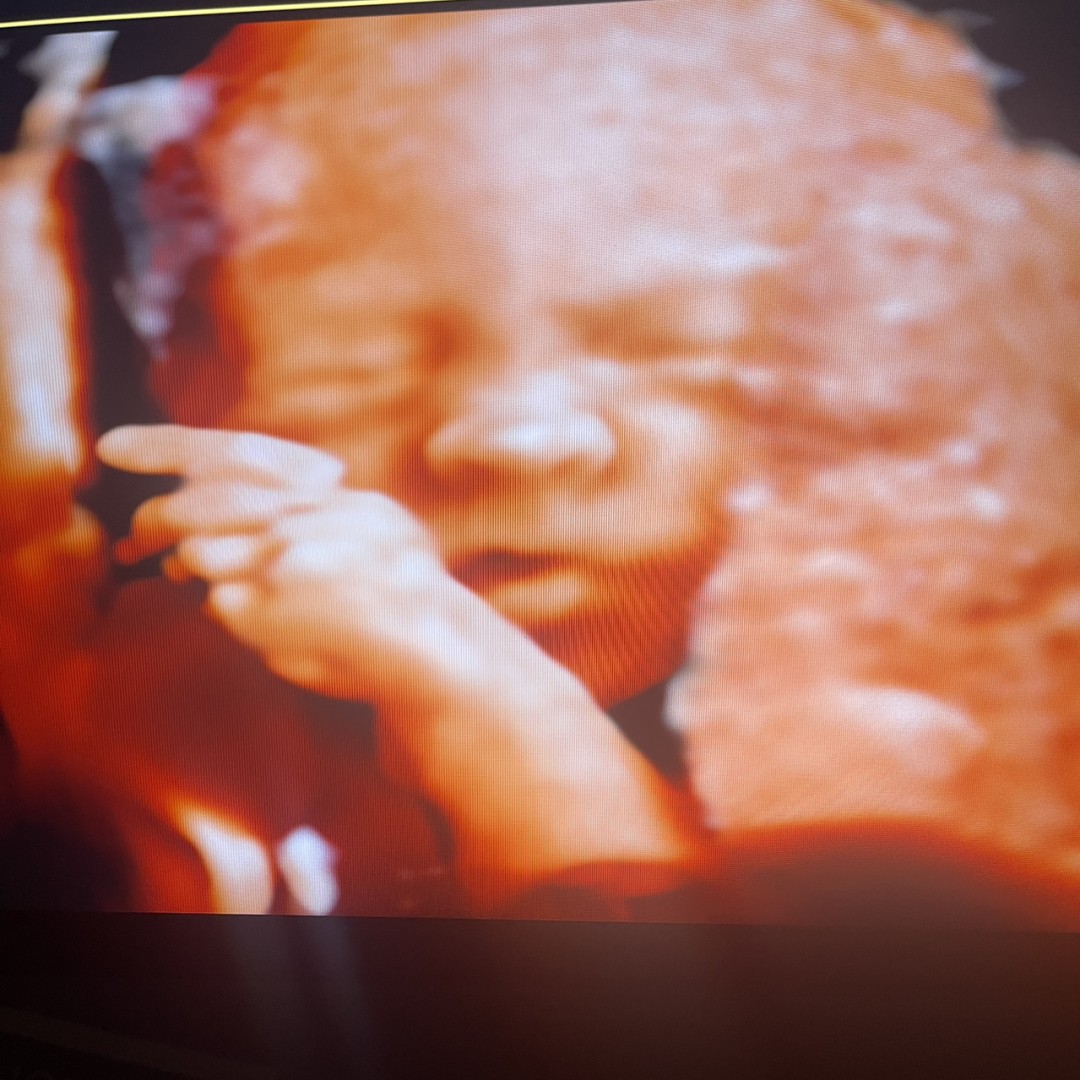 Photo shared by Destiny for their Babylist baby registry.