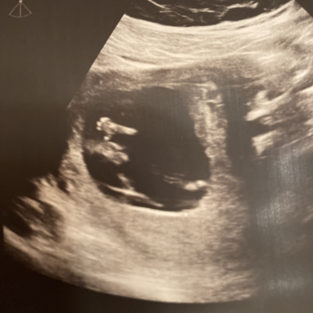 Photo shared by Crystal for their Babylist baby registry.