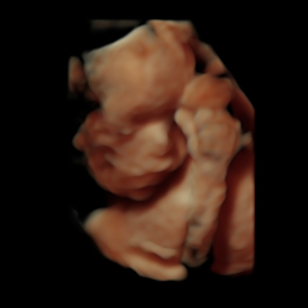 Photo shared by Christina for their Babylist baby registry.
