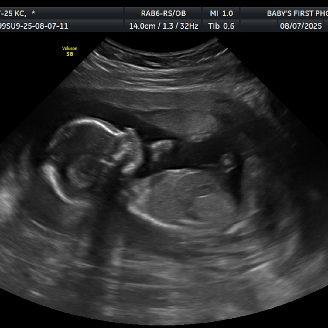 Photo shared by Katie for their Babylist baby registry.