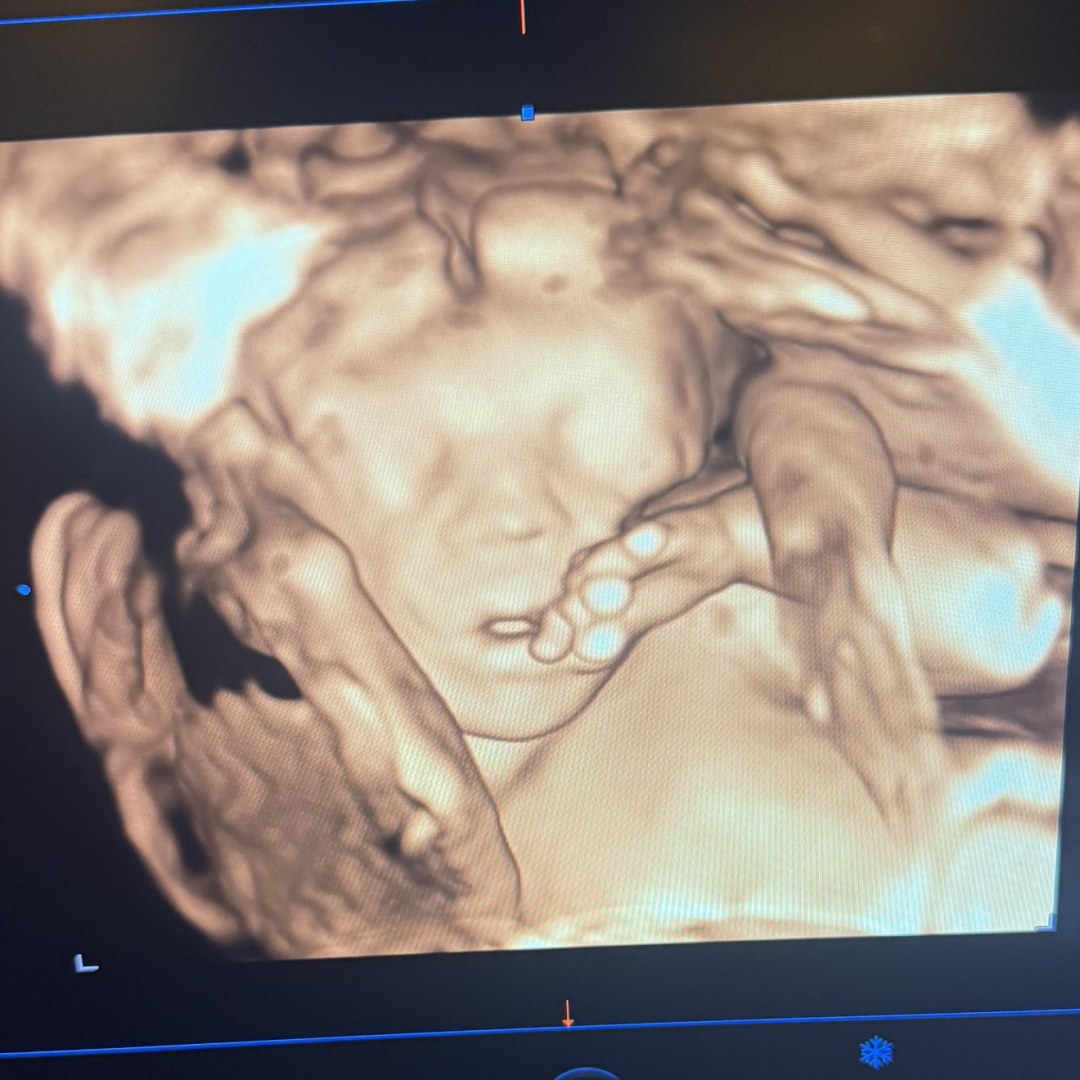 Photo shared by Jessie for their Babylist baby registry.