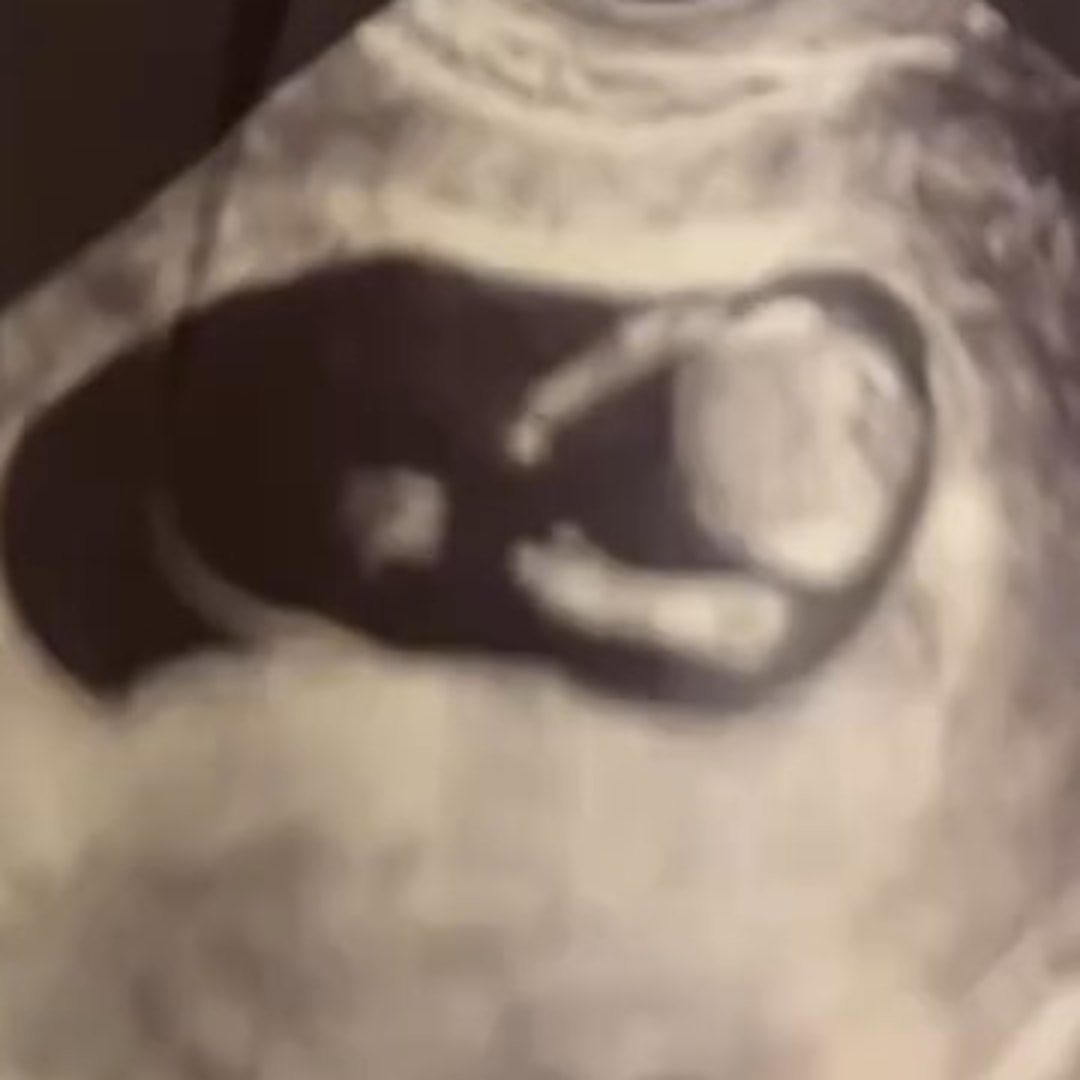 Photo shared by Shelby for their Babylist baby registry.