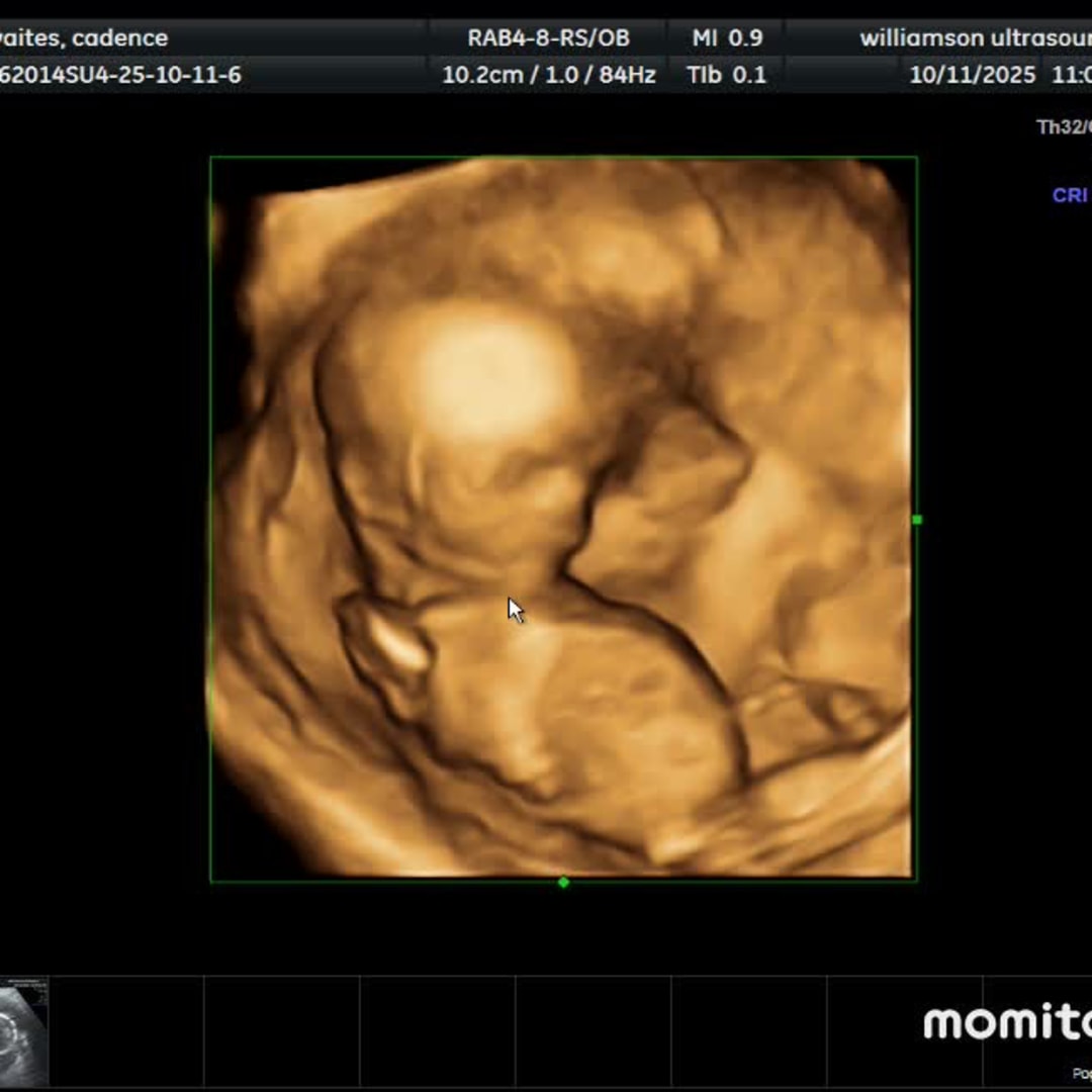 Photo shared by Cadence for their Babylist baby registry.