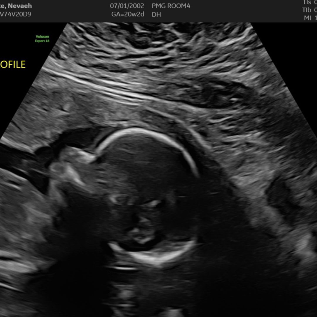 Photo shared by Nevaeh for their Babylist baby registry.