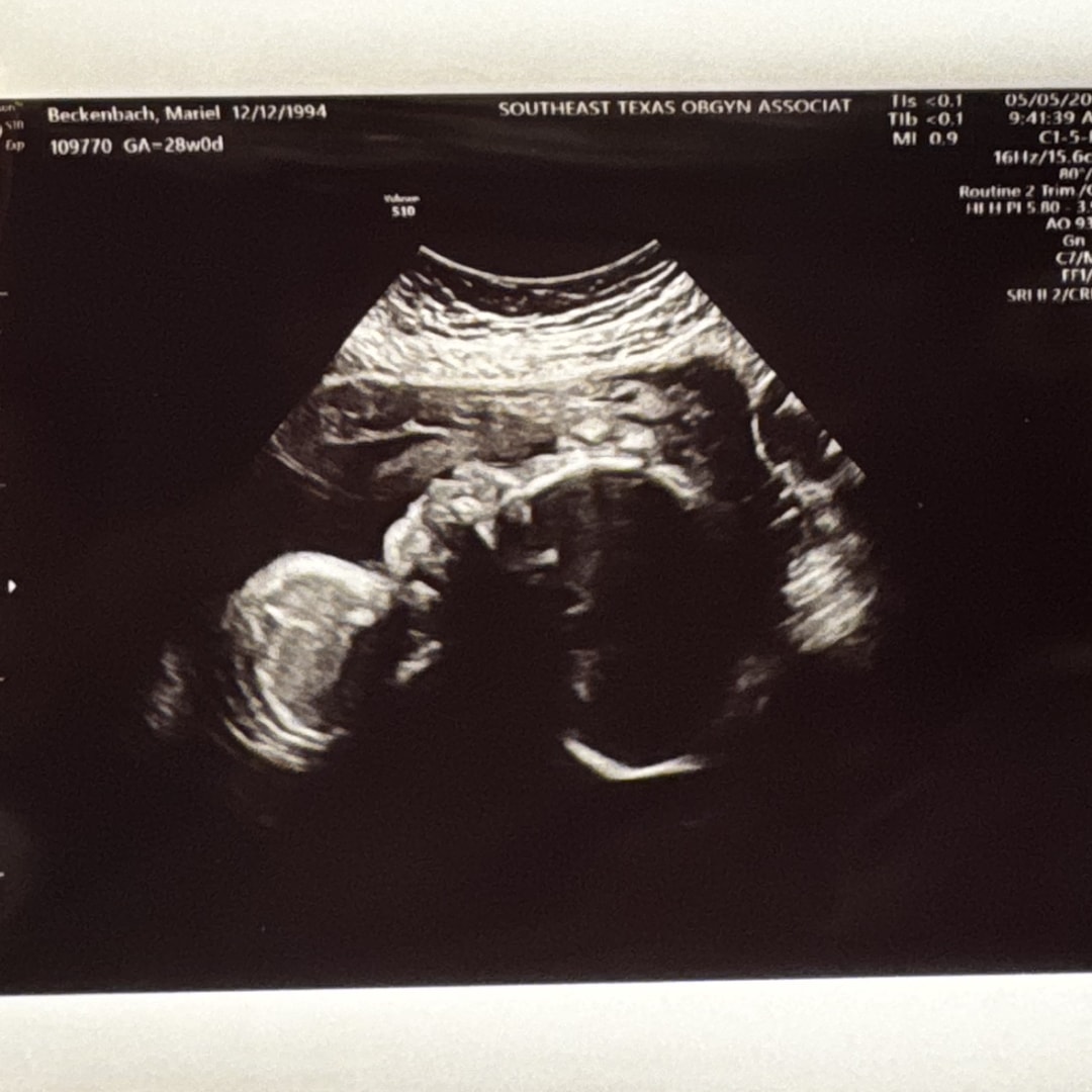 Photo shared by Mariel for their Babylist baby registry.