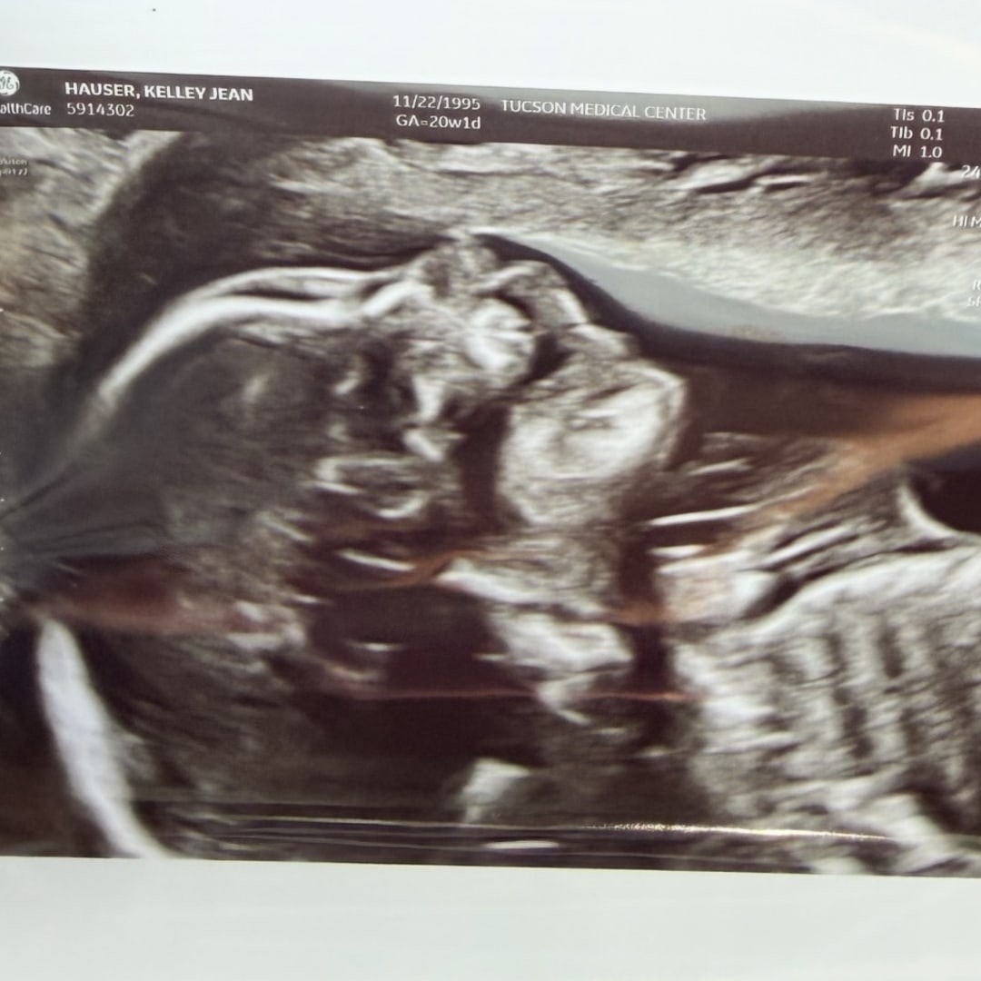Photo shared by Kelley for their Babylist baby registry.