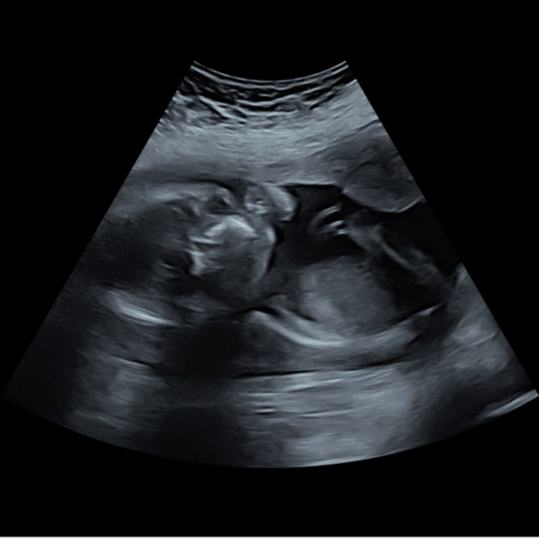 Photo shared by Delia for their Babylist baby registry.