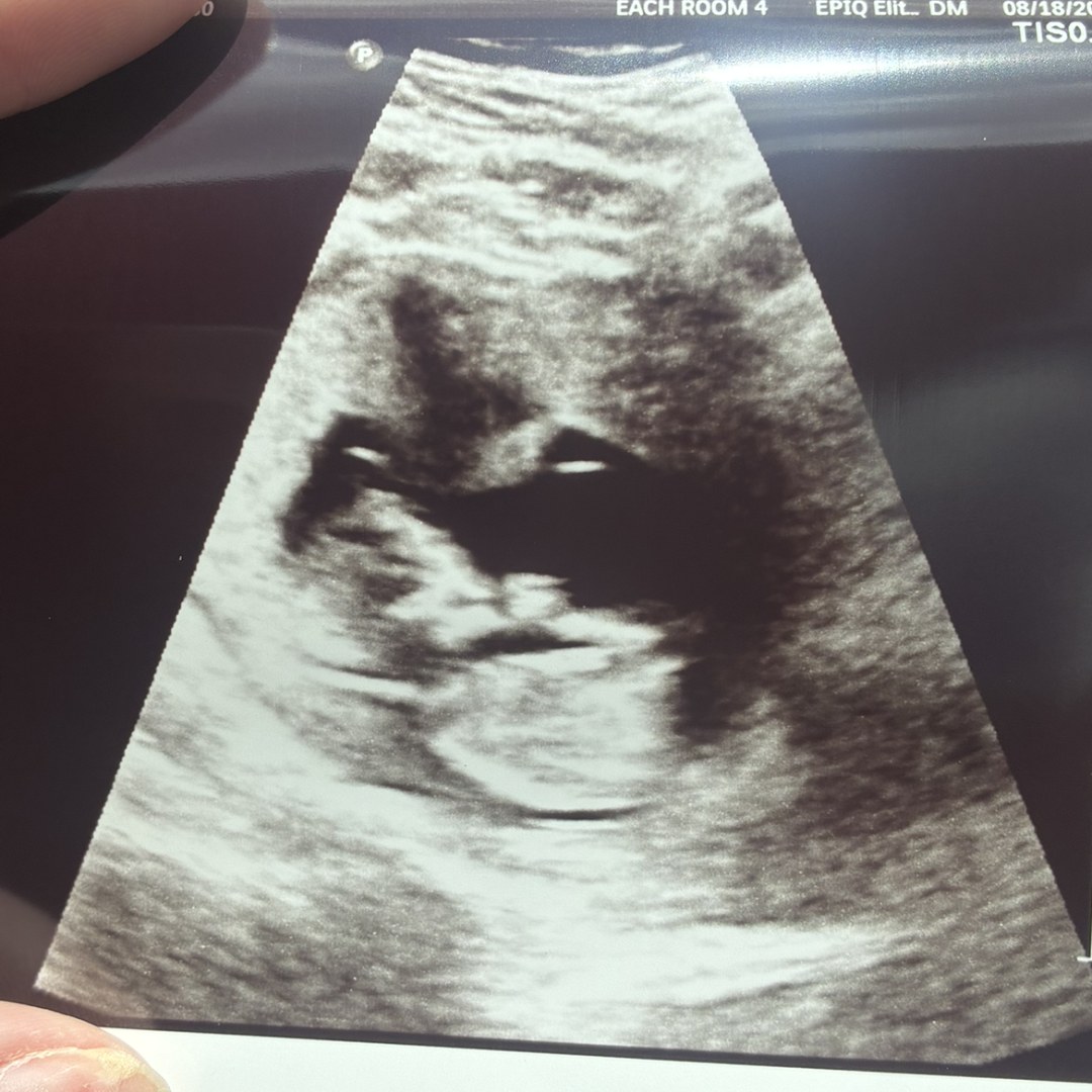 Photo shared by Chloe for their Babylist baby registry.