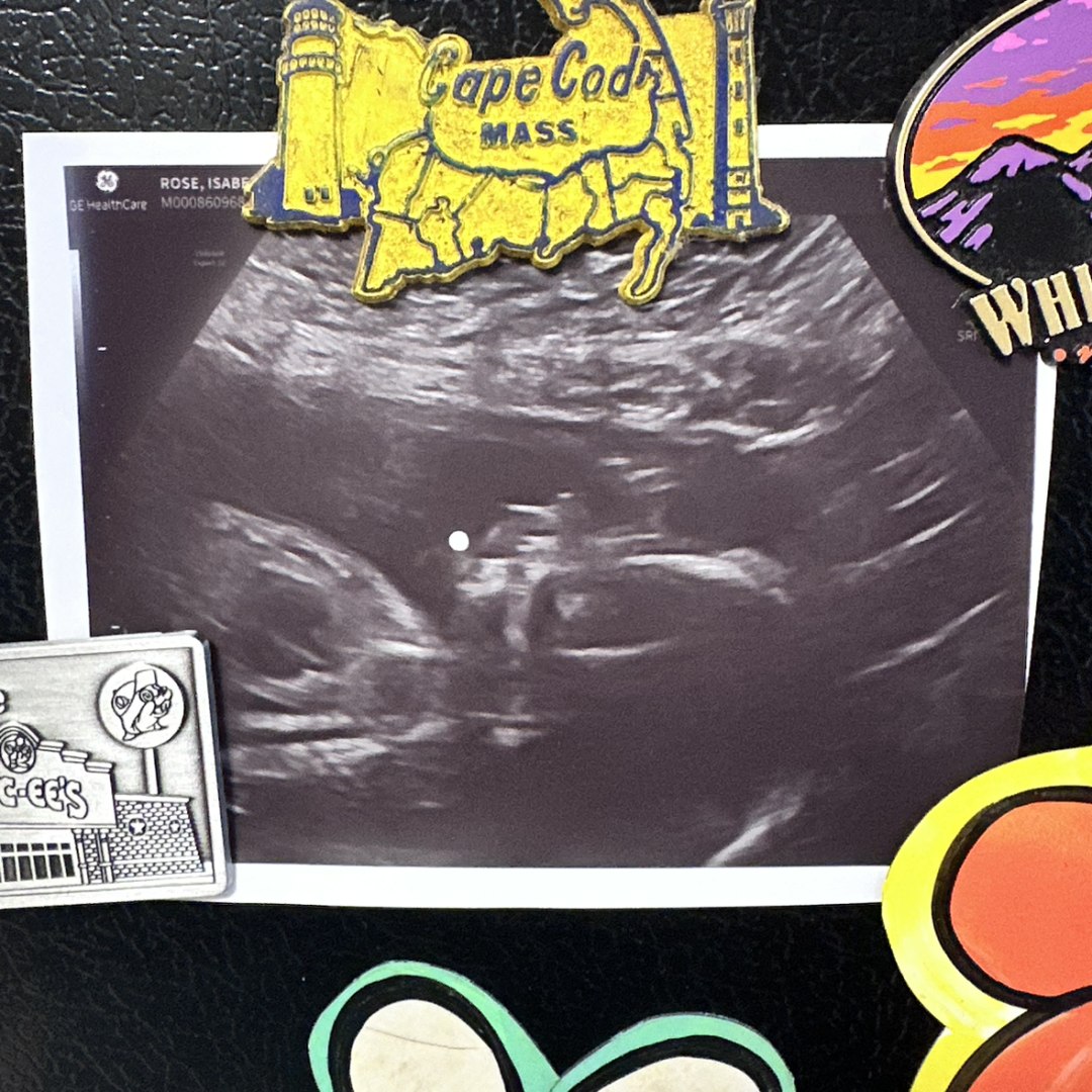 Photo shared by Bella for their Babylist baby registry.