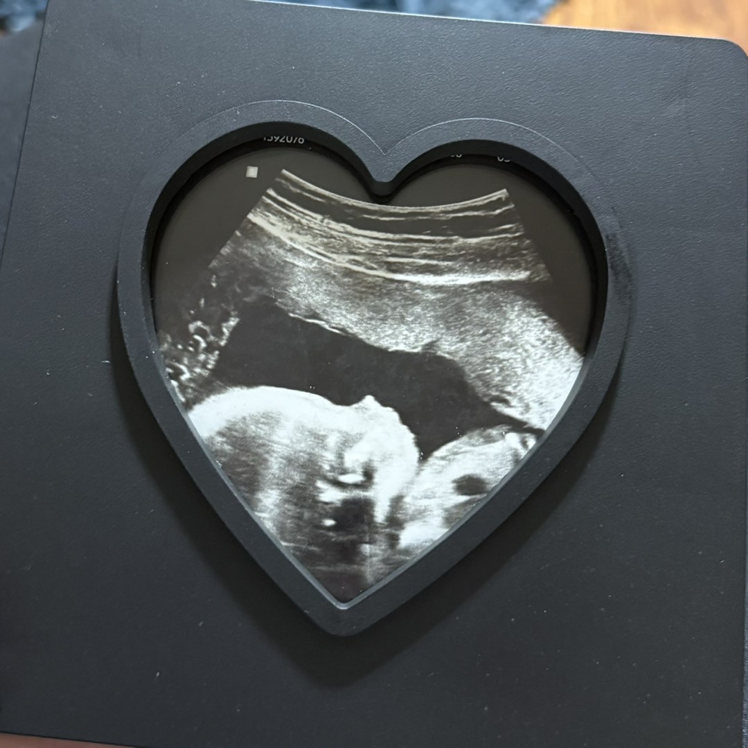 Photo shared by Virginia for their Babylist baby registry.