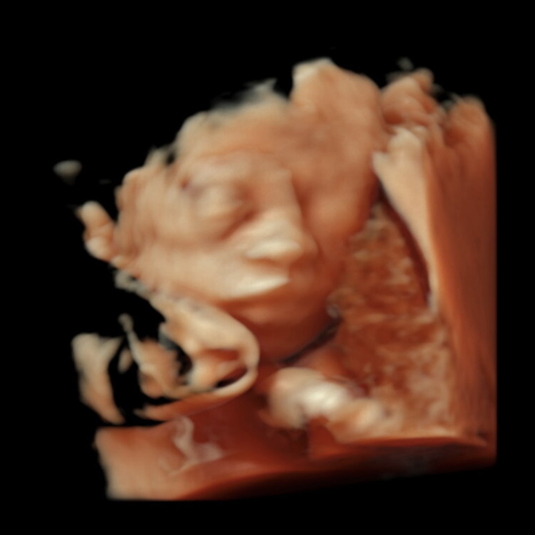 Photo shared by Keiara for their Babylist baby registry.