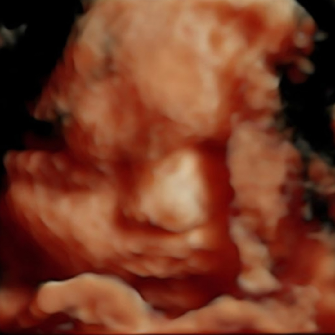 Photo shared by Jenna for their Babylist baby registry.