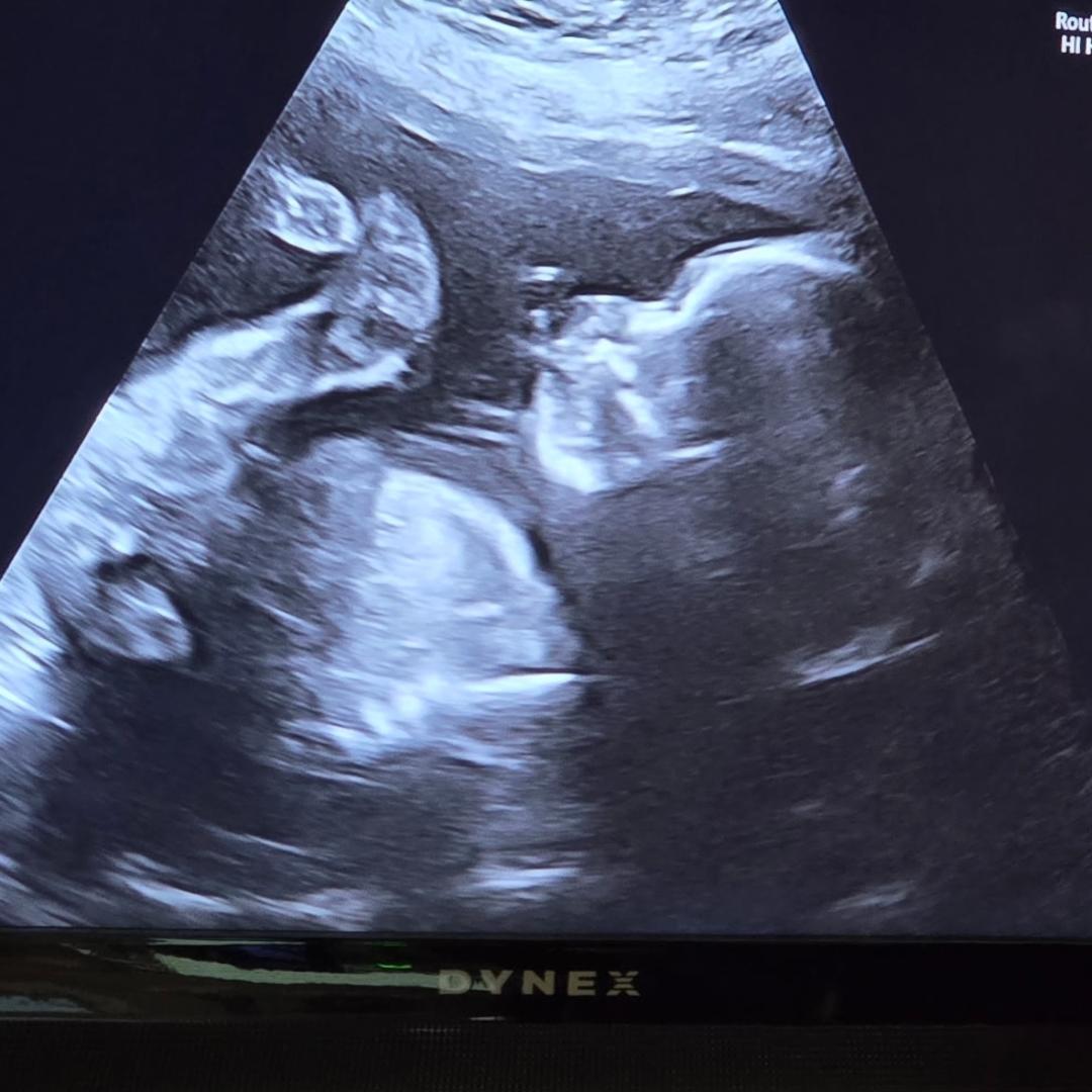 Photo shared by Adriana for their Babylist baby registry.