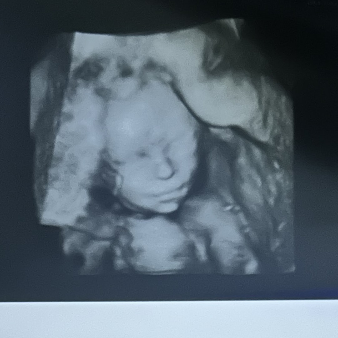 Photo shared by Katelynn for their Babylist baby registry.