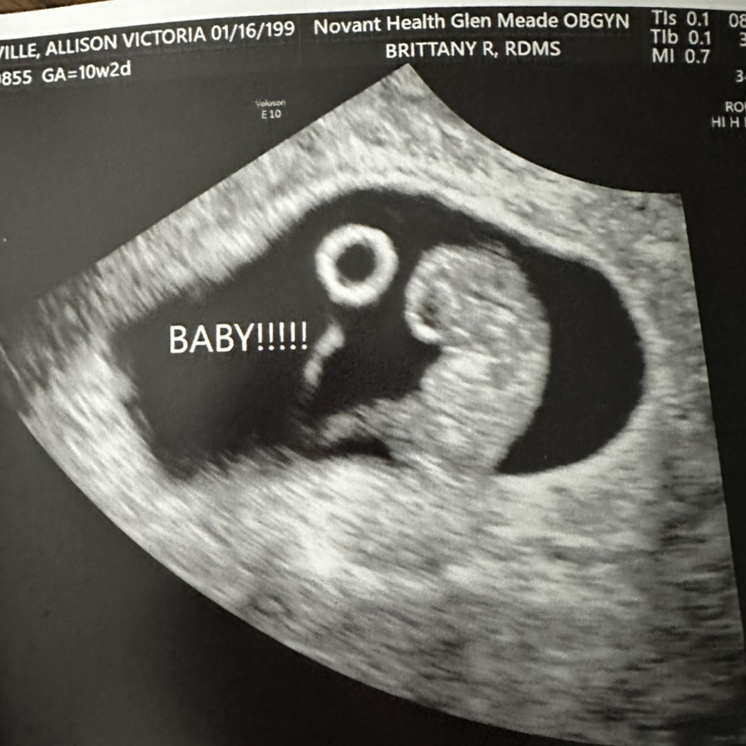 Photo shared by Allison for their Babylist baby registry.