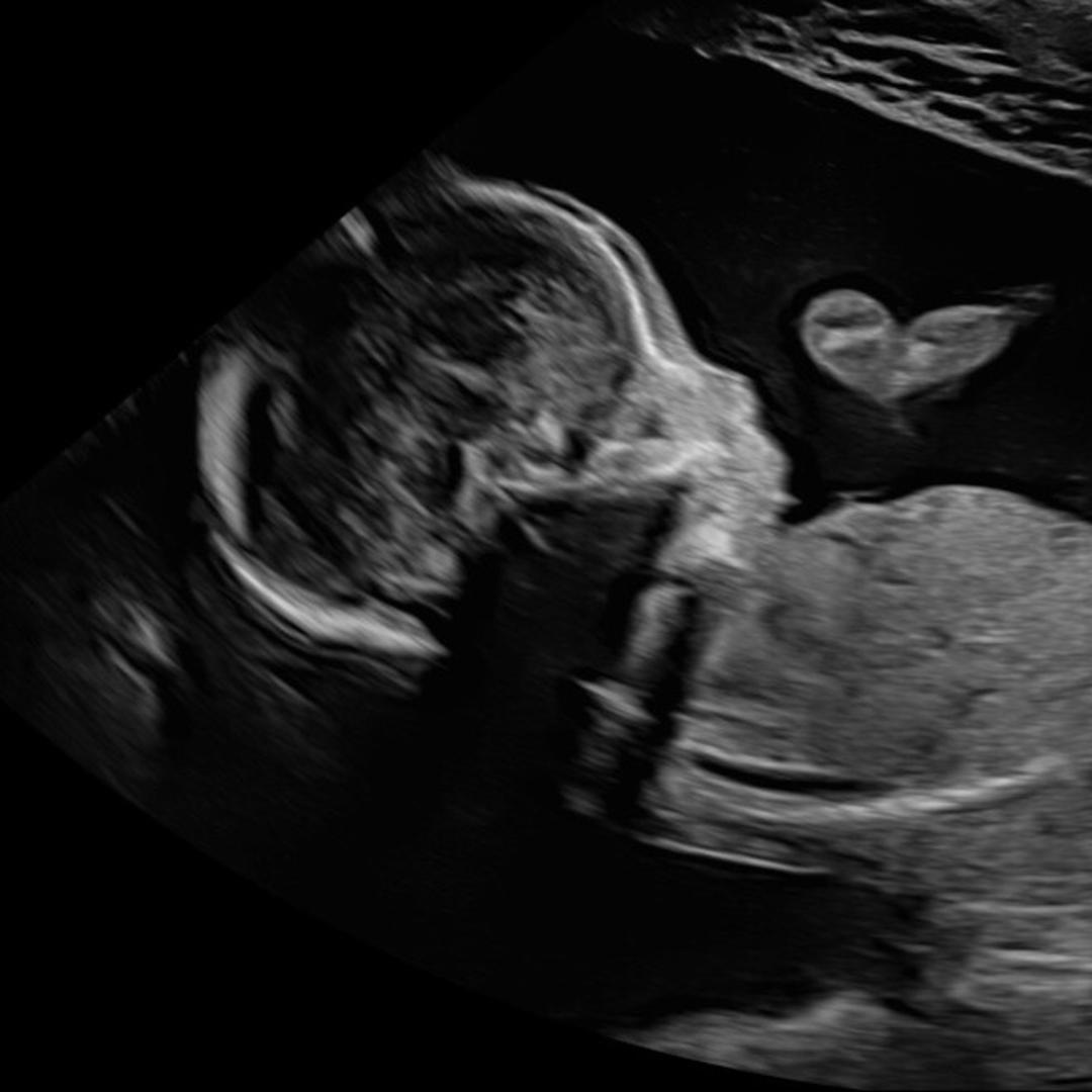 Photo shared by McKenna for their Babylist baby registry.