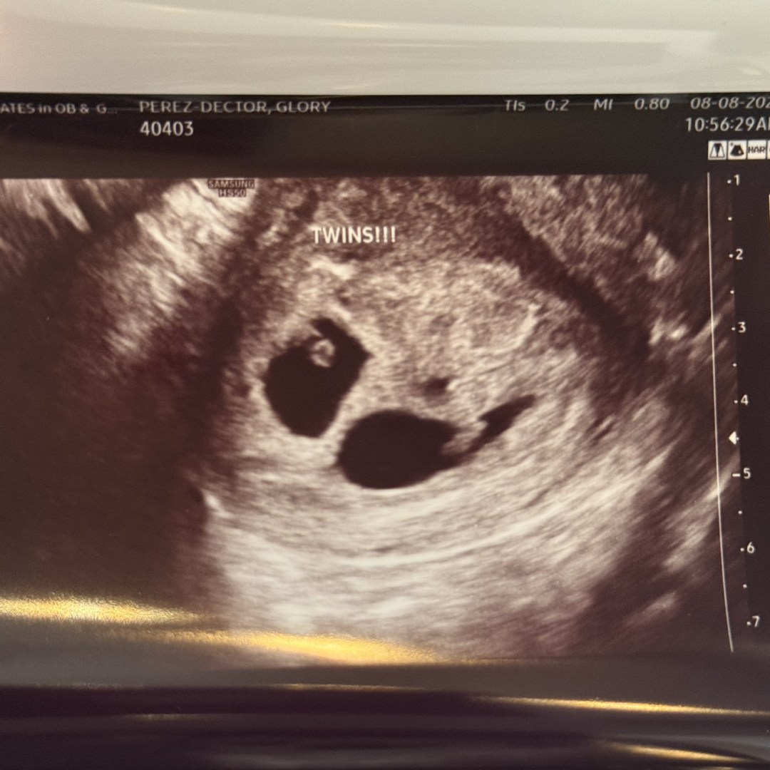 Photo shared by Arizbeth for their Babylist baby registry.