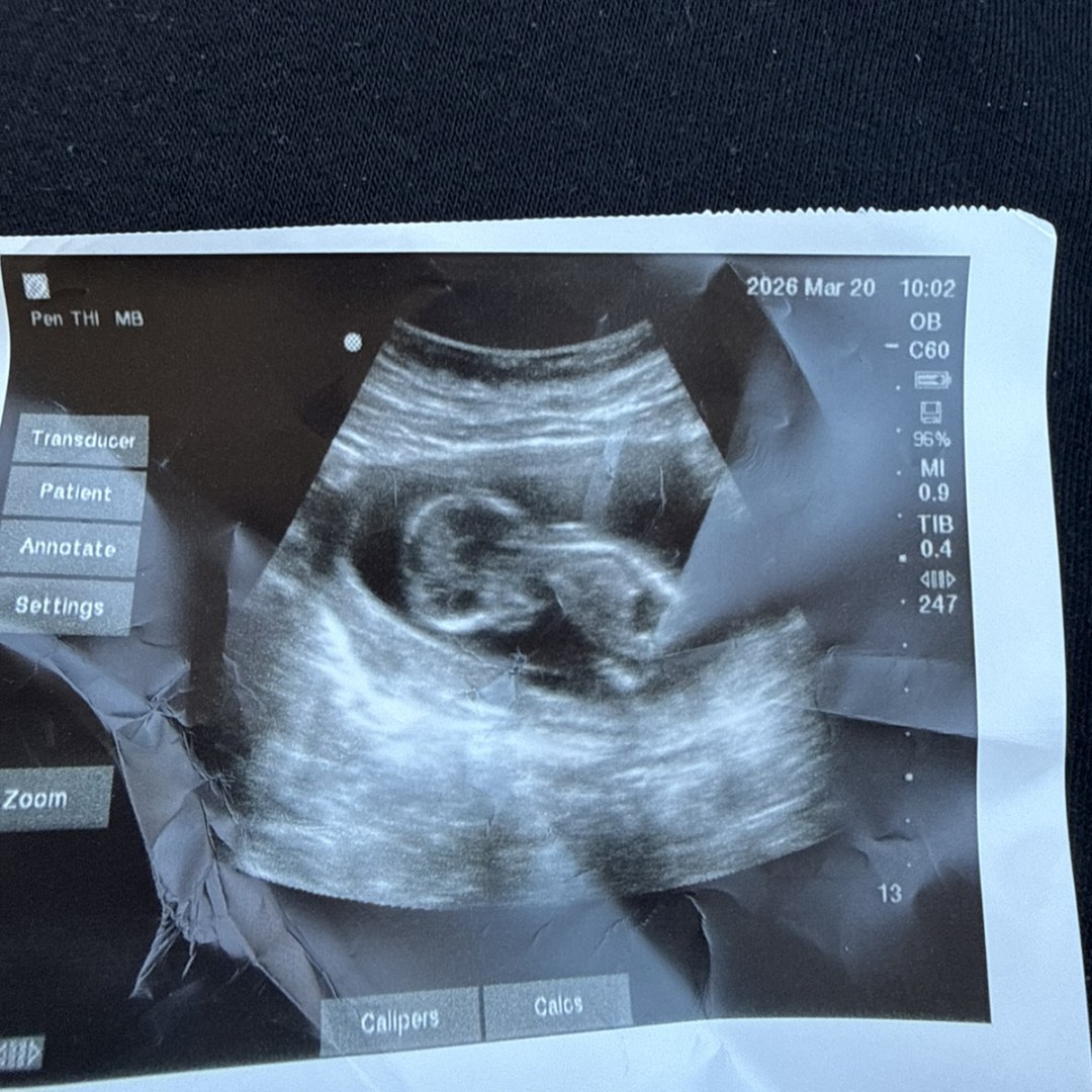 Photo shared by Bernel for their Babylist baby registry.