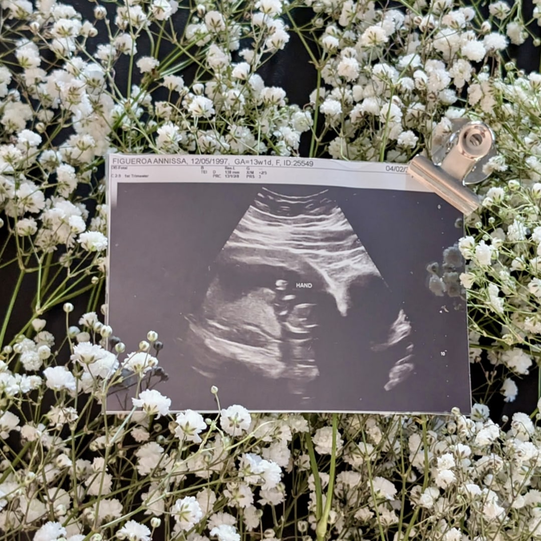 Photo shared by Annissa for their Babylist baby registry.