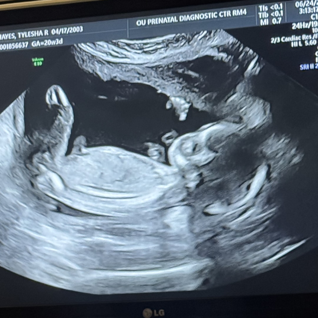 Photo shared by Tye for their Babylist baby registry.