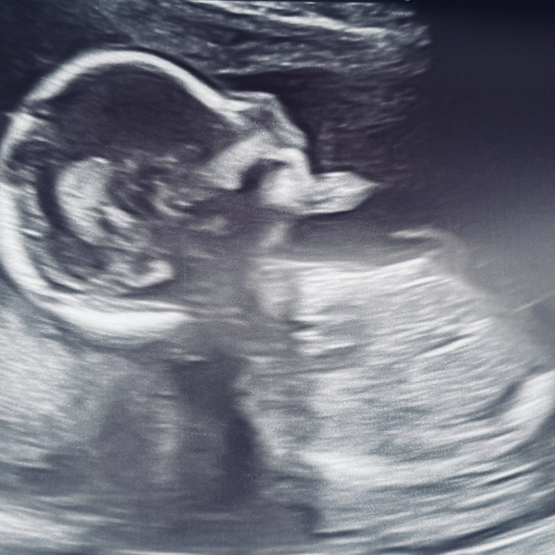Photo shared by Kaitlyn for their Babylist baby registry.
