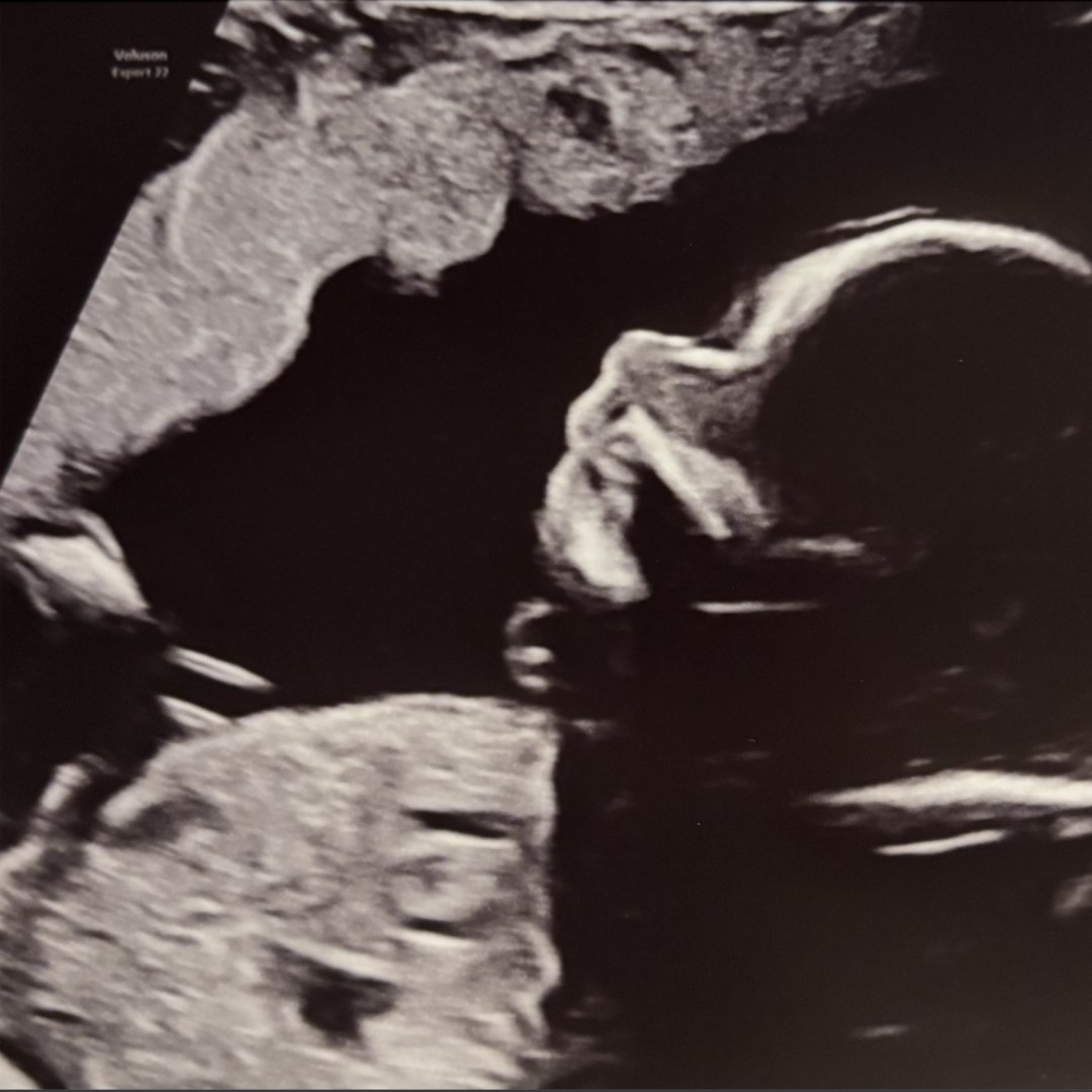 Photo shared by Lindsey for their Babylist baby registry.