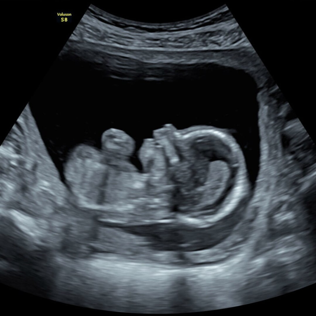 Photo shared by Addie for their Babylist baby registry.