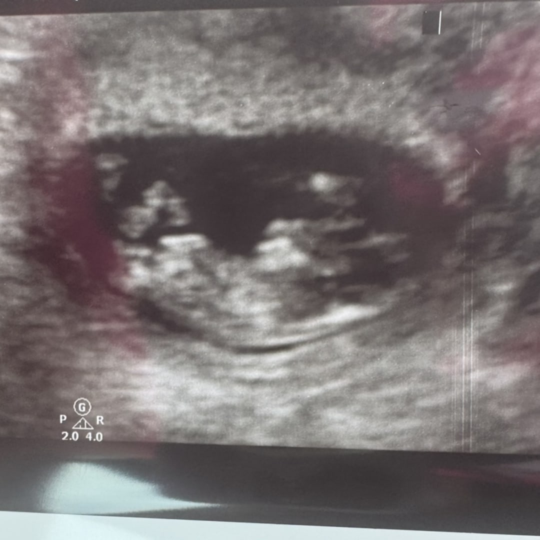 Photo shared by Jojo for their Babylist baby registry.