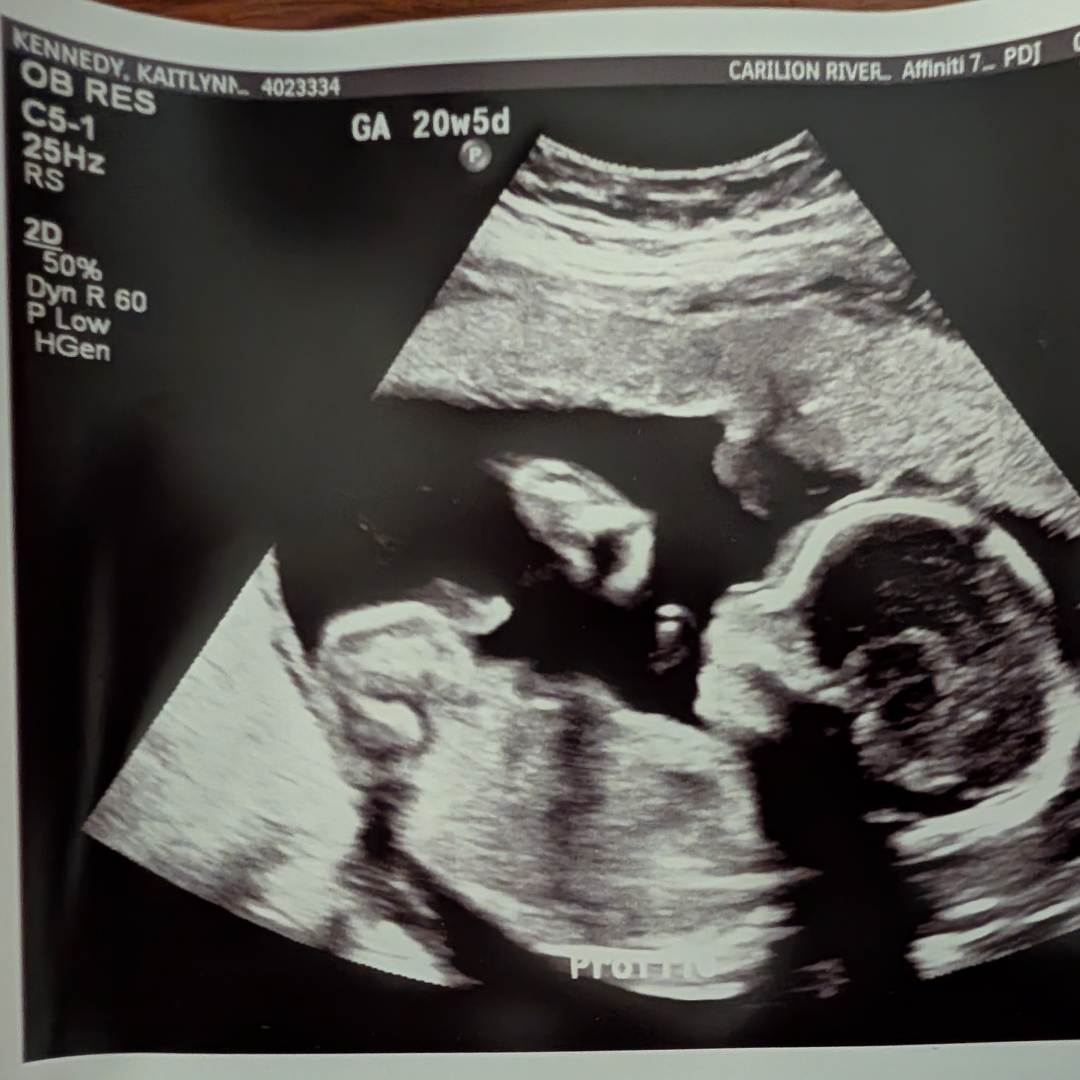 Photo shared by Mike for their Babylist baby registry.