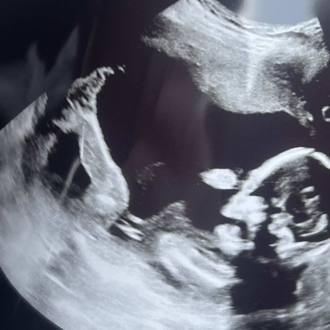 Photo shared by Chloe for their Babylist baby registry.